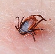 Tick bite